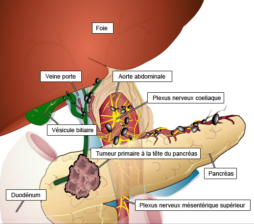 Les canaux biliaires  Société canadienne du cancer